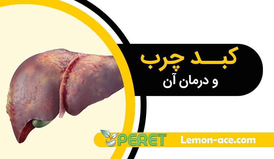 کبد چرب و درمان کبد چرب با عرق کاسیا