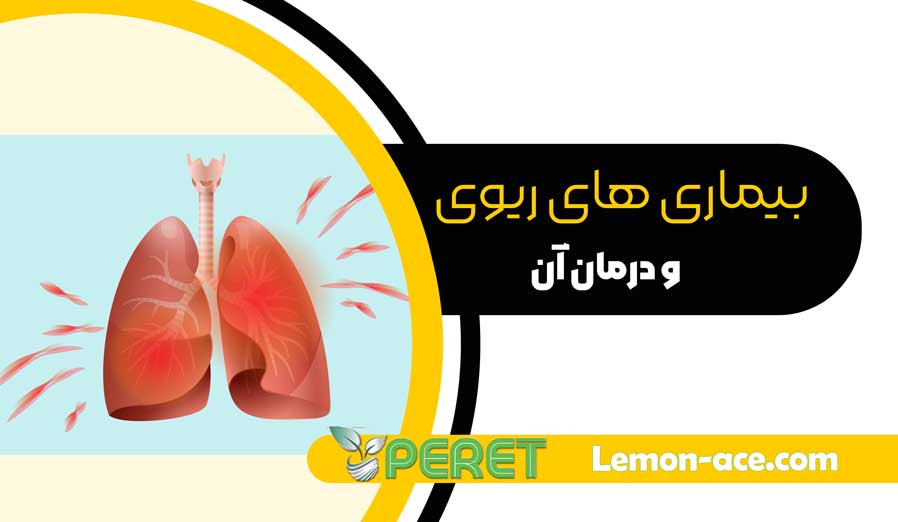 بیماری-های-ریوی